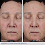 ELASTIDERM® LIFT UP & SCULPT FACIAL MOISTURIZER