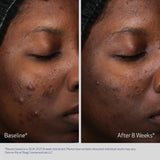 RETINOL + PHA