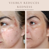 Luxury Beauty Serum