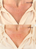 Decollete, Breast, & Butt Occlusion Patch™
