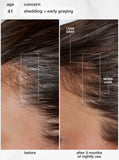 FutureIQ™ biomimetic hair longevity serum