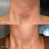 SILICONEFUSION™ Neck Patch