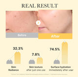 Kojic Acid Turmeric Gold Jelly Gel Mask (Single)