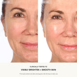 Resurfacing Flash Peel