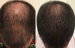 Revolve Hair Loss Shampoo Treatment for Men