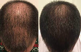 ZENAGEN REVOLVE HAIR LOSS SHAMPOO TREATMENT FOR MEN