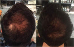 ZENAGEN REVOLVE HAIR LOSS SHAMPOO TREATMENT FOR MEN