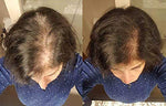 Revolve Hair Loss Shampoo Treatment for Women