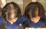 Revolve Hair Loss Shampoo Treatment for Women
