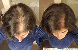 ZENAGEN REVOLVE HAIR LOSS SHAMPOO TREATMENT FOR WOMEN