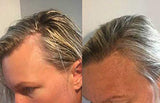 Revolve Hair Loss Shampoo Treatment for Women